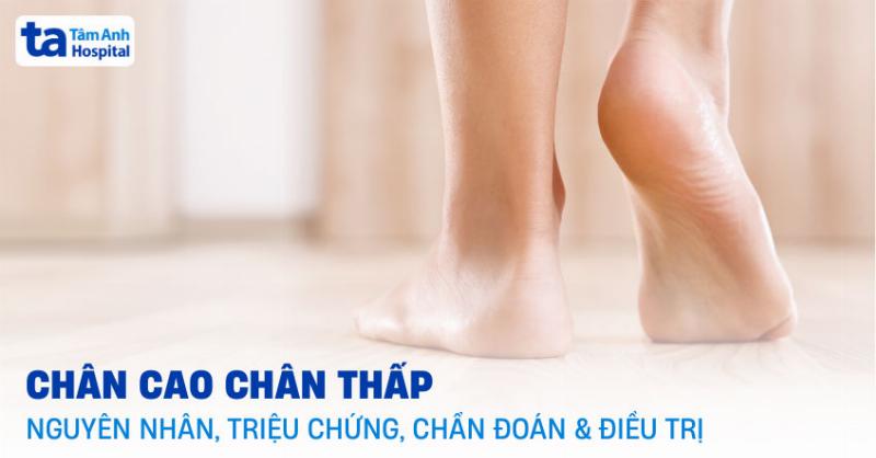 Ảnh hưởng của chiều cao lên bước chân