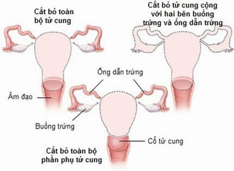 Minh họa tại sao đường sức điện không thể cắt nhau