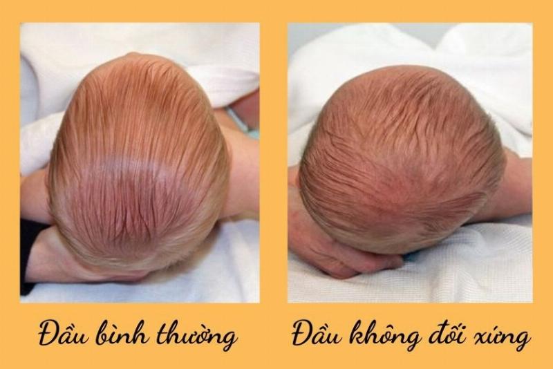 Meo giup tre quay vung cai thien thang bang